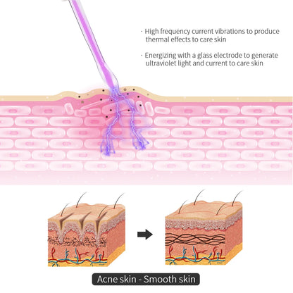 ClearPulse Skin Care Wand